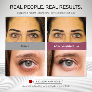 Time Keeper Wrinkle Reducing LED Face Mask