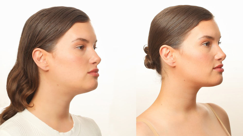 RolLift - Reduce double chin, redefine your jawline, tighten loose neck skin - FDA CLEARED - luminanrg